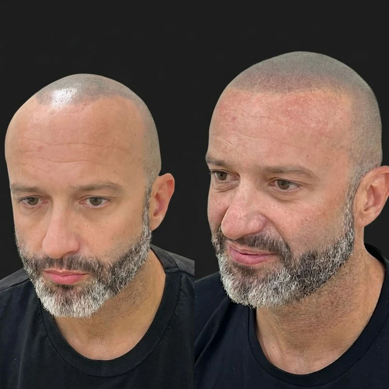 SIMONE AT 05